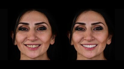 Study shows DTS PRO results are very good to excellent