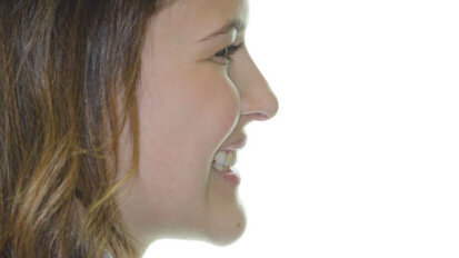 Estetika je budoucnost ortodoncie