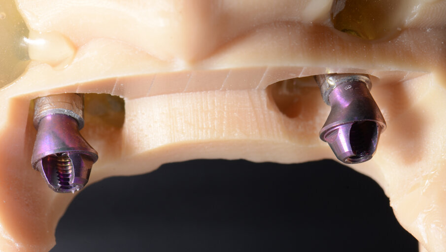 Fig. 44 - SRA Straumann.