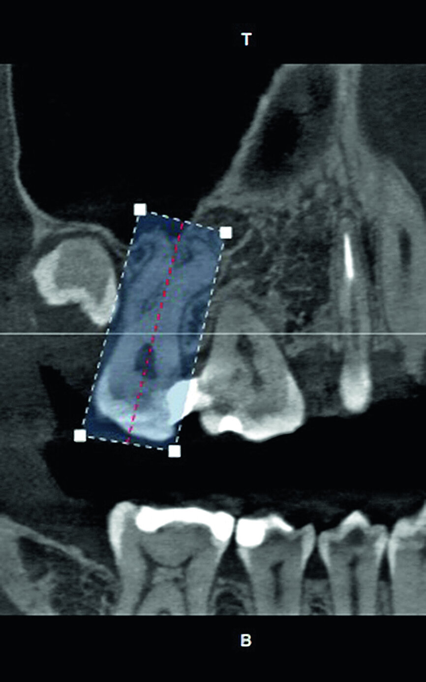 Fig. 5a: Selection of the tooth to be examined.