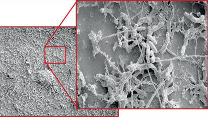 Quando l’infezione rientra fra i rischi lavorativi e assistenziali dello studio odontoiatrico