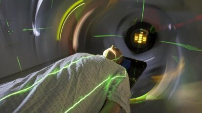 Nieuwe bestralingstechniek voorkomt droge mond