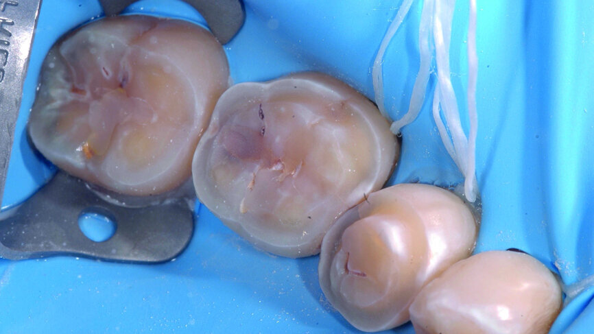 Fig. 4a : Vue des préparations pour table tops
