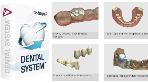 Webinar: Experte präsentiert Neuerungen des 3Shape Dental System 2015