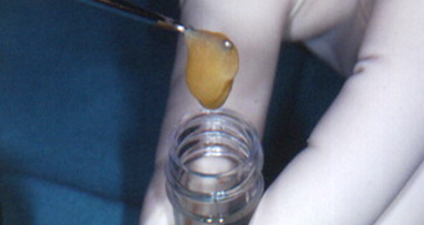 Analiza efektywności czynników wzrostowych zawartych w PRP i Emdogain