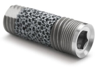 Trabecular Metal Dental Implant Trabecular Metal Dental Implant
