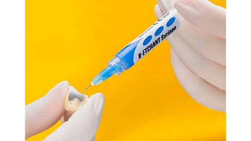 K-ETCHANT Syringe (GRC)