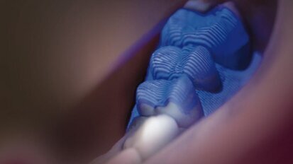 La CFAO florissante au plus grand salon mondial d'art dentaire