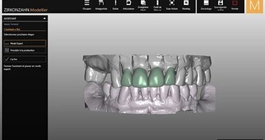 En busca de la sonrisa perdida (2)