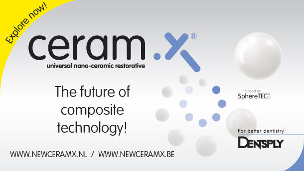 CERAM.X met nieuwe fillertechnologie