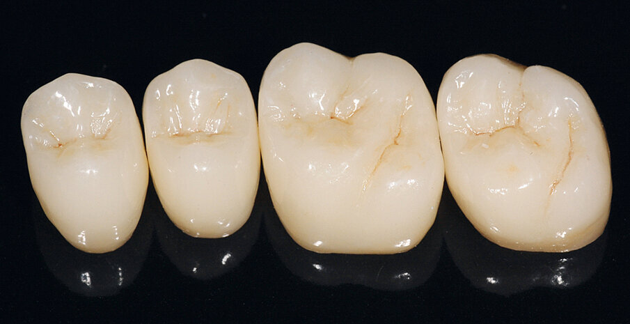 Fig. 8: Monolithic crowns after having been finalized, crystallized and characterized.