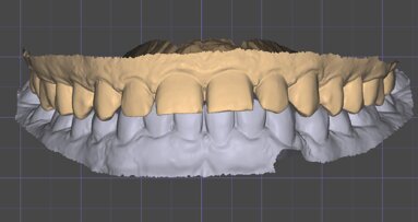 La prima visita odontostomatologica: un evento rivoluzionato dalla moderna tecnologia digitale