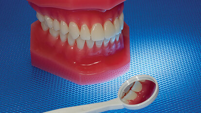 Genetic variation linked to increased periodontitis risk Genetic variation linked to increased periodontitis risk
