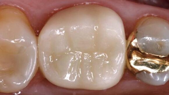 25 lat sprawdzonej klinicznej wydajności