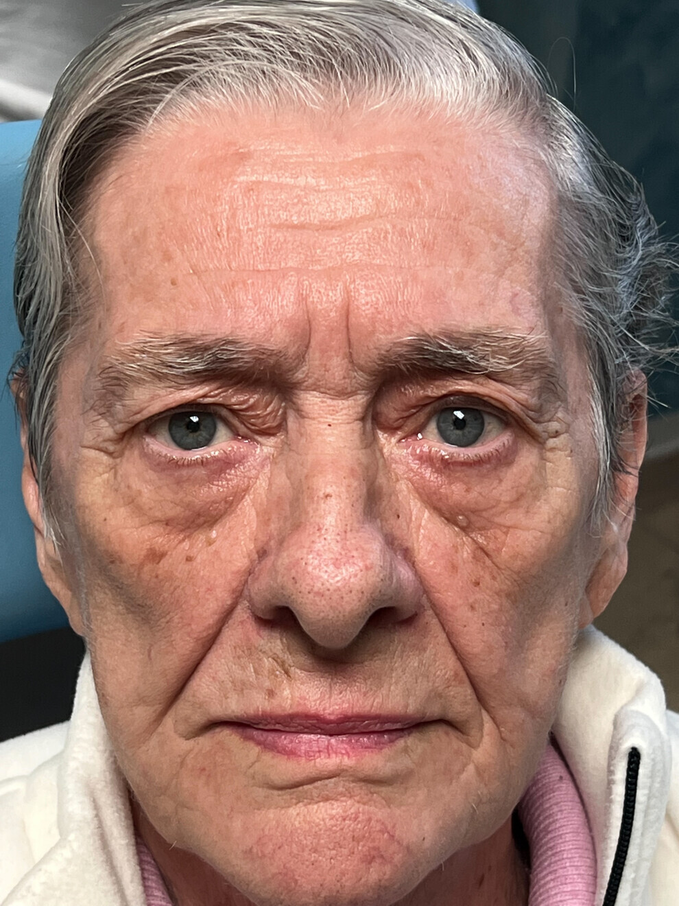 Fig. 1: Initial facial photograph.