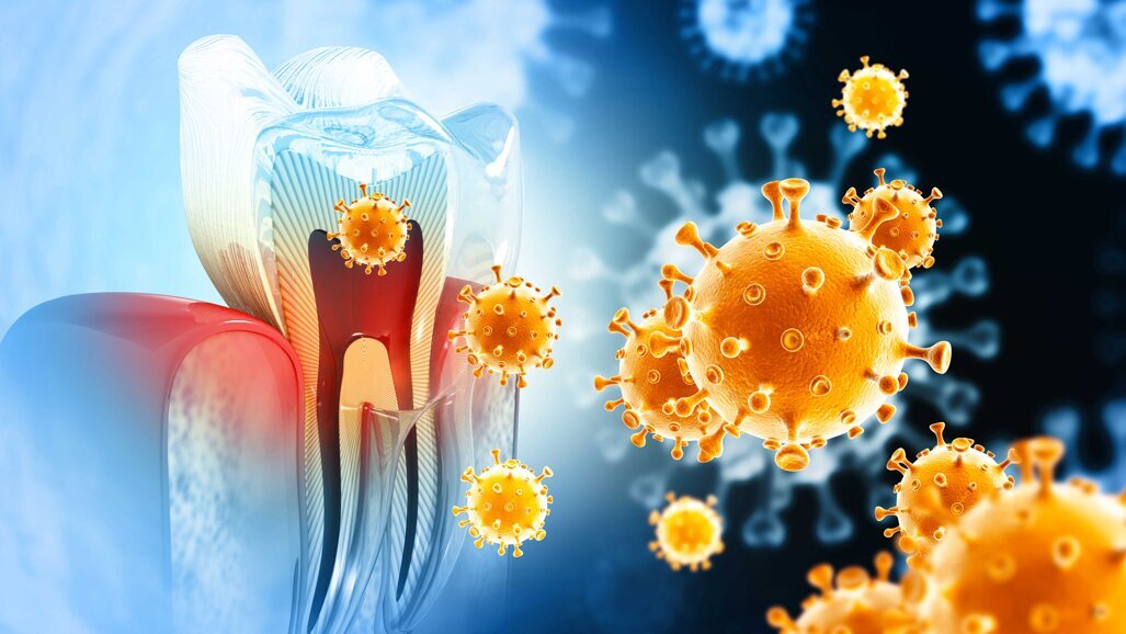 DNA-codiertes Nanozym-Sensor-Array gegen Zahnbakterien