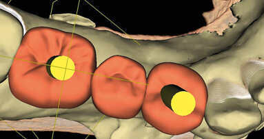 Reliable planning for an optimal workflow. User case abstract