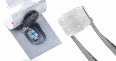 Changing the game in bonding with APC Flash-Free Adhesive