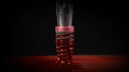 Keystone Dental Group – Genesis BioSpark Hydrophilic Surface