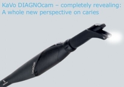KaVo DIAGNOcam