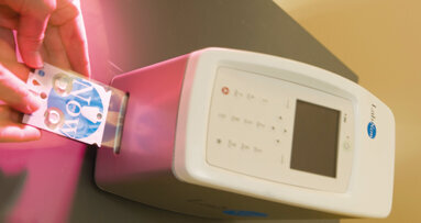 New test to detect oral cancer