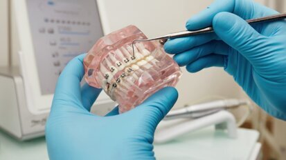 Ortodoncja – nie tylko dla dzieci i nastolatków