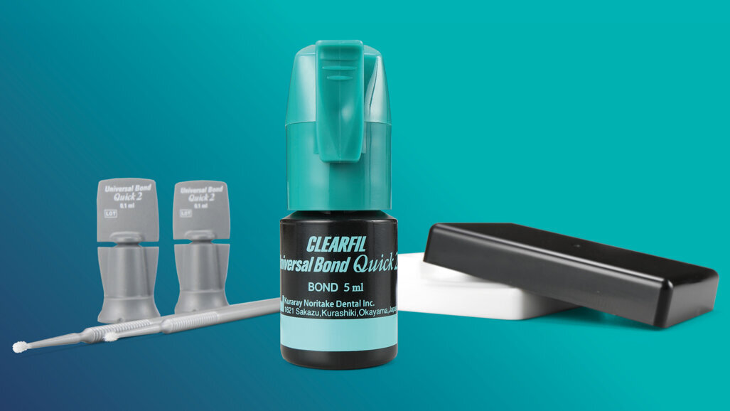 Simplifying the bonding process without compromising on quality