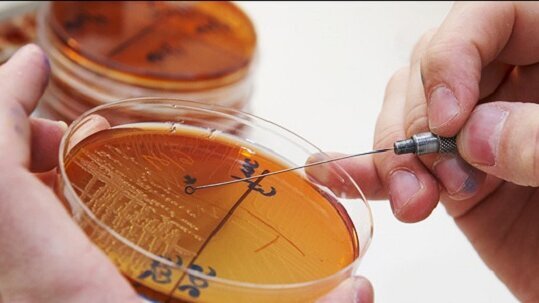 Καρκίνος κεφαλής και τράχηλου. Νέο σύστημα απλοποιεί τον θεραπευτικό σχεδιασμό