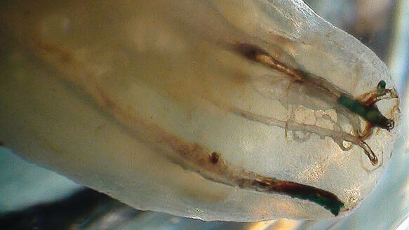 Interview: 'The immense variability of human tooth anatomy'