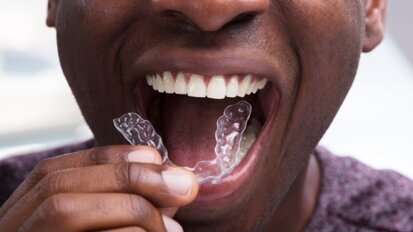 Why home treatment kits cannot replace a medical professional