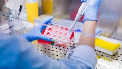 Förderung für Projekt zu parodontalen Mesenchymalen Stammzellen