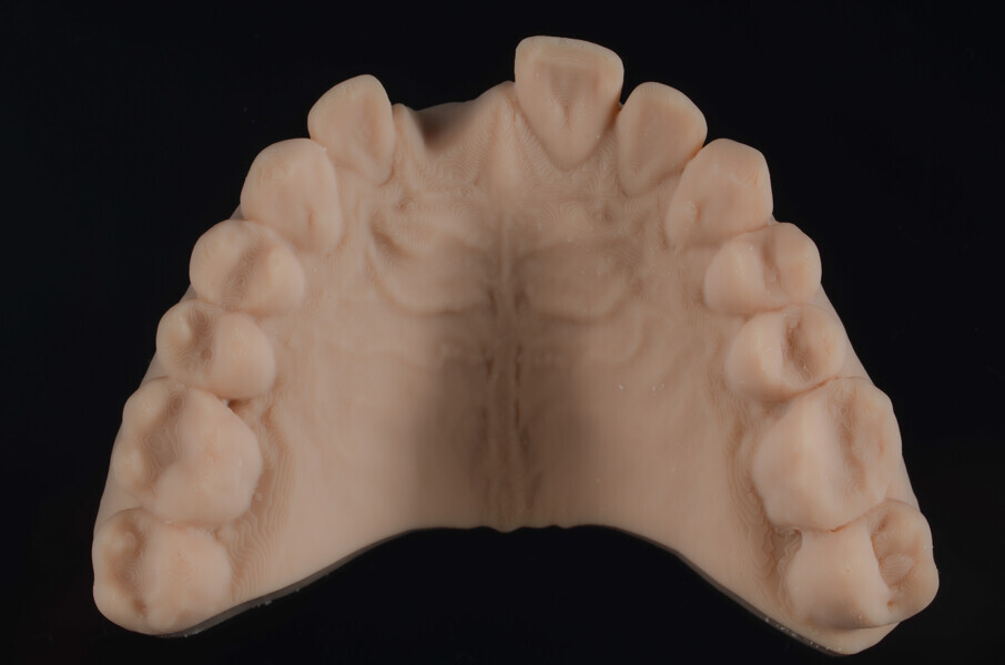 Fig. 5b: Models after virtual extraction 3D-printed from Asiga DentaMODEL using the MAX UV, occlusal view.