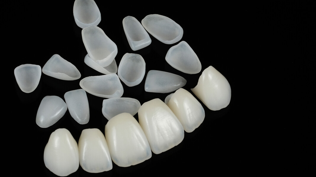 Fig. 25: Final restorations ready for fit assessment.