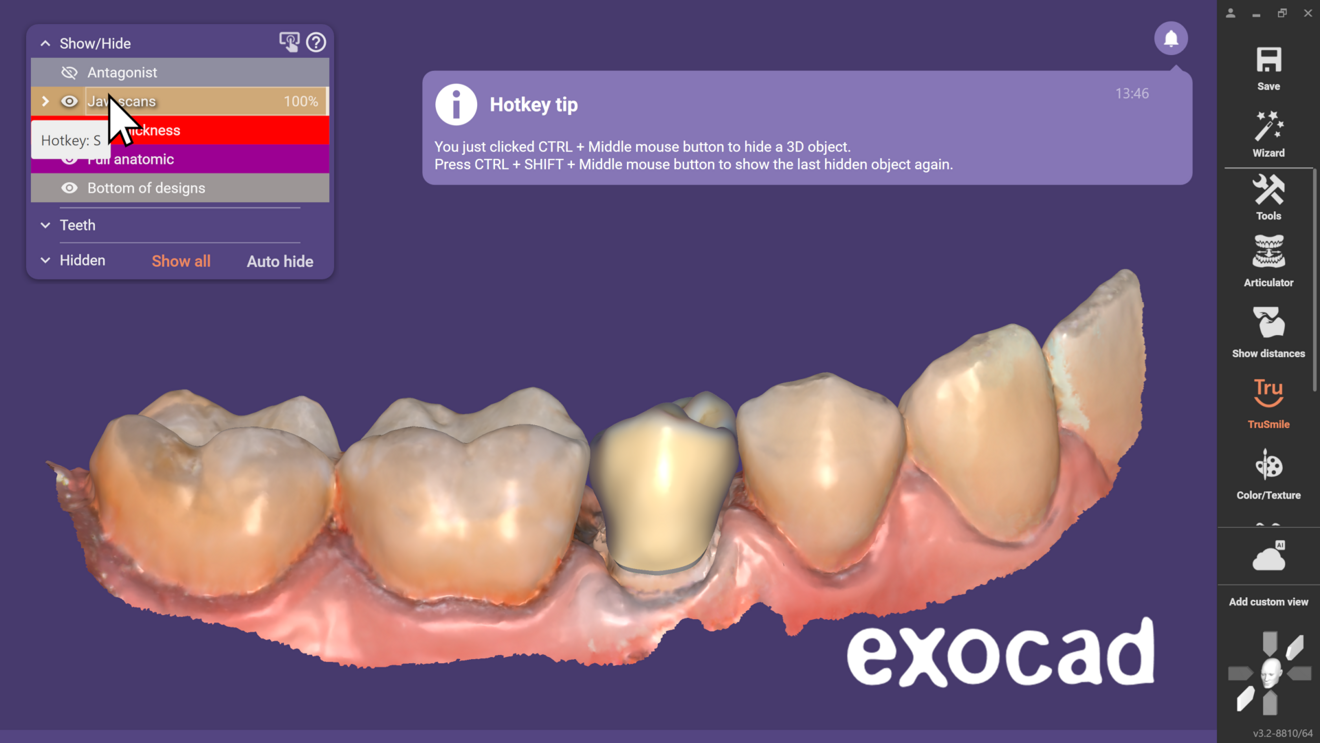 Fig. 5: The practical tool tips in the Show/Hide window show the corresponding hot key for each object, allowing for quick visibility changes. If a user forgets the hot key for an object, DentalCAD provides an automatic reminder