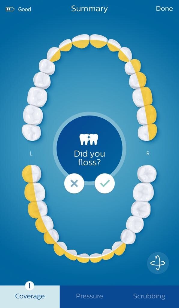 In this overview, the yellow areas show that some areas were not given enough attention during the brushing session. After the brushing session, a reminder asks if the patient flossed, used mouthwash and cleaned their tongue.