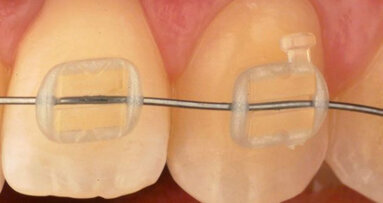 Spaanse onderzoekers lanceren nieuwe generatie onzichtbare slotjes