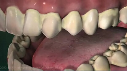 Free web-based patient education software released Free web-based patient education software released