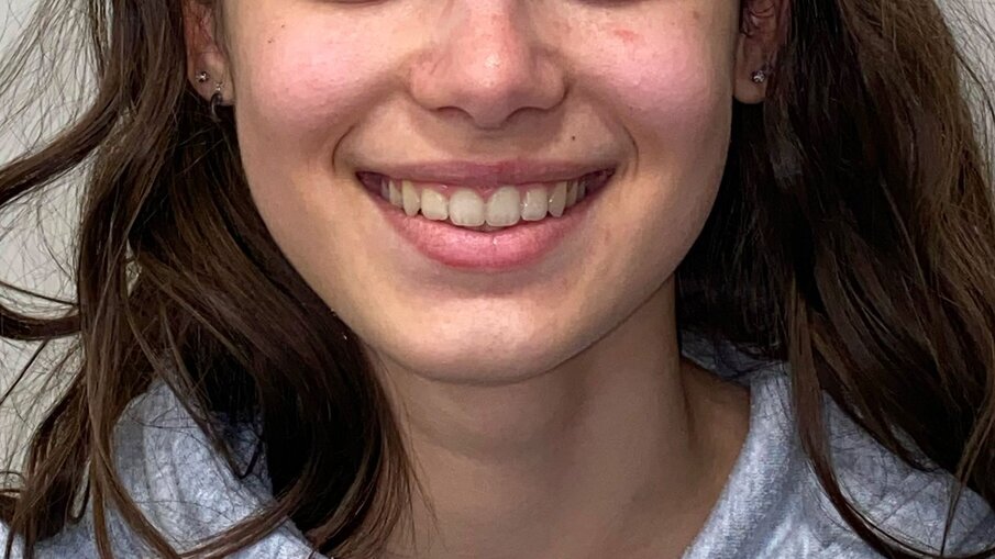 Fig. 15_Viso sorriso post-trattamento.