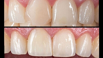 Determinación y reproducción del color Determinación y reproducción del color