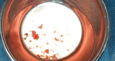 Biomateriales naturales