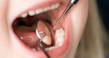 Mondgezondheid tieners verslechterd