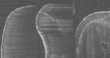 Vizualne informacije in slikovna tehnologija v endodontiji