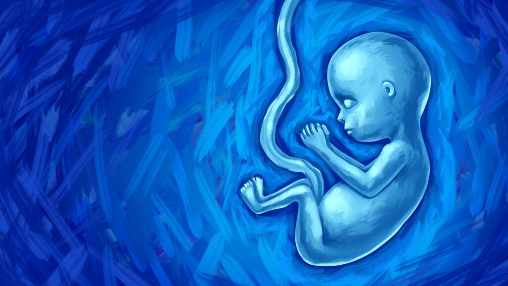 Study examines oral health of individuals with foetal alcohol spectrum disorder