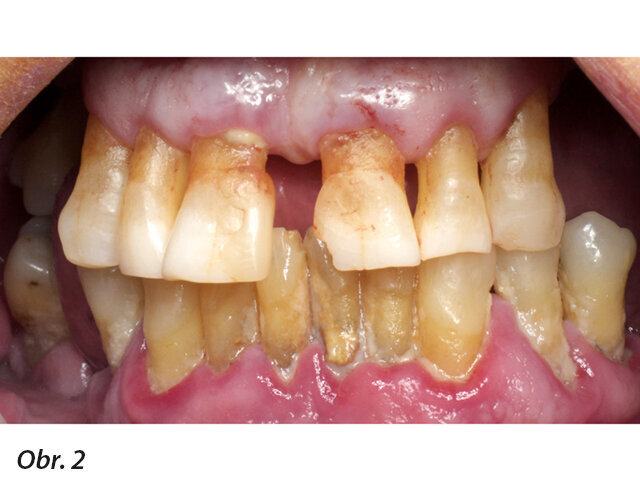 Kazuistika - iniciální situace