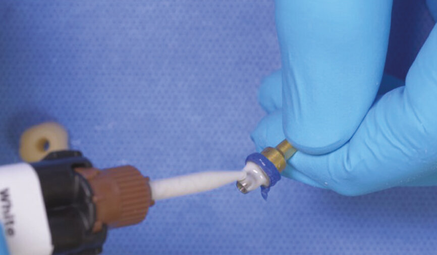 Fig. 8: Inject PANAVIA SA Cement Universal (in the white shade) on to the treated and cleaned abutment. 