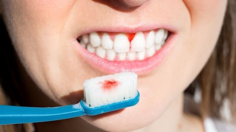 Forse besparingen en betere gezondheid door preventie van parodontitis