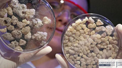 Weihrauch als Entzündungshemmer?