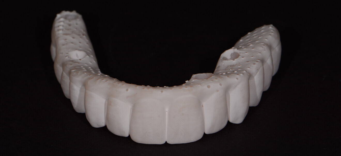 Fig. 2: Printed all-on-X try-in made from V-Print Try-In (VOCO).