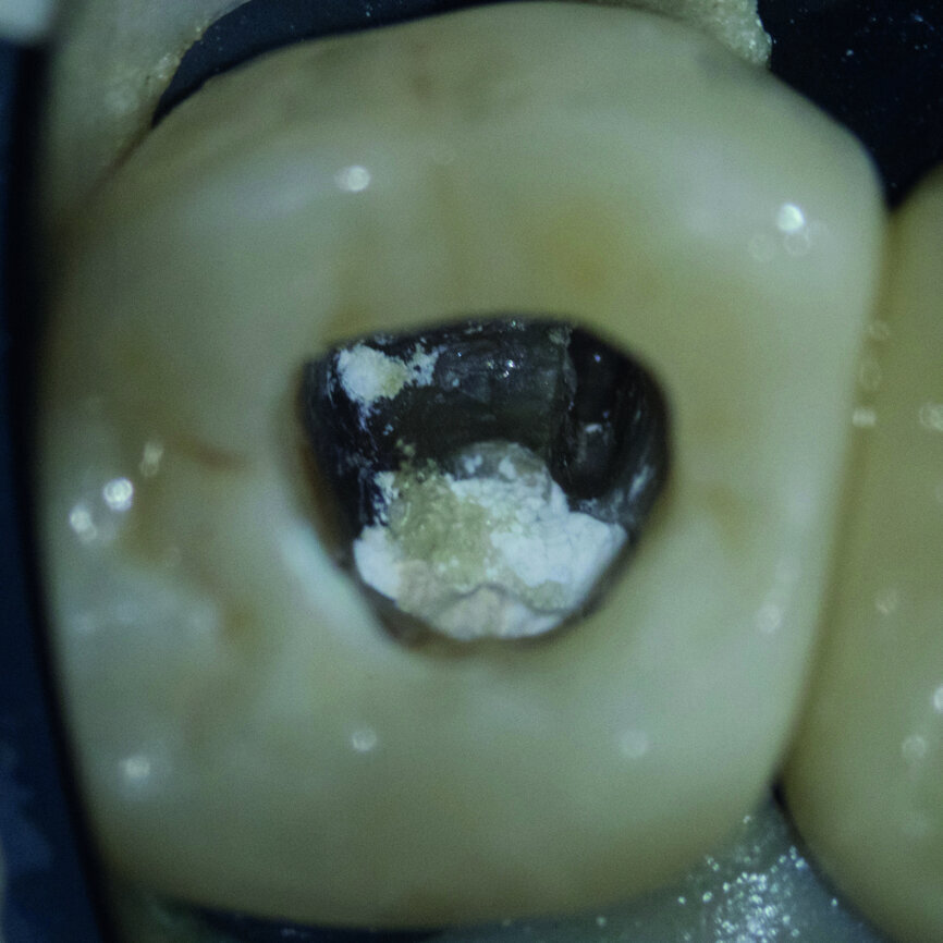 Fig. 6 : Le ciment hydraulique à base de silice après sa prise complète.