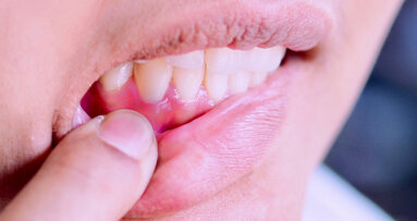 New study explains link between obesity and periodontal disease